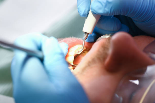 Best Broken or Cracked Tooth Emergency Dentist in Las Quintas Fronterizas, TX