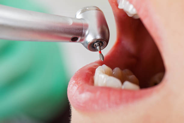 Best Emergency Root Canal Treatment in Las Quintas Fronterizas, TX